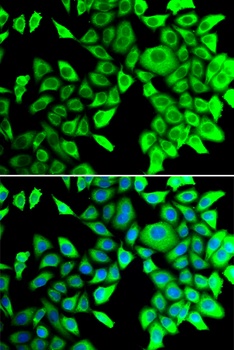 THADA Antibody