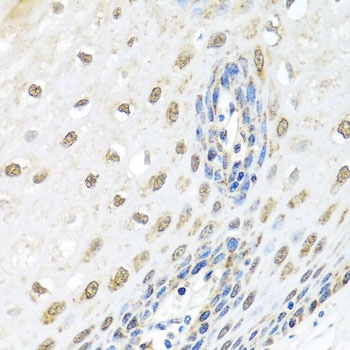 ELAC2 Antibody