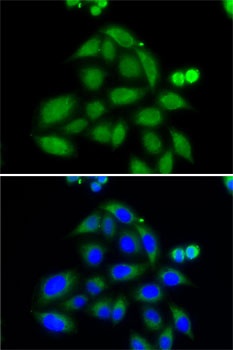 ELAC2 Antibody