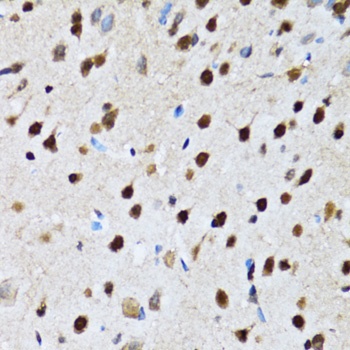 CCAR2 Antibody