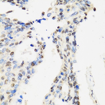 CCAR2 Antibody