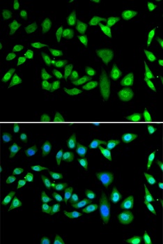 CCAR2 Antibody