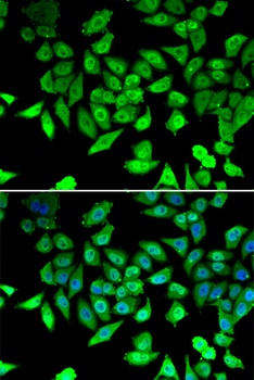 CCAR2 Antibody