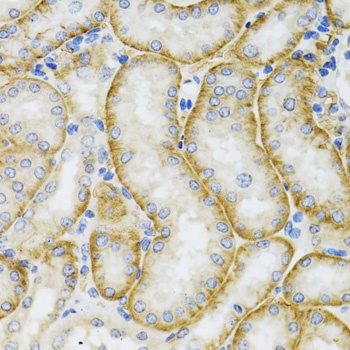 ARFGAP1 Antibody