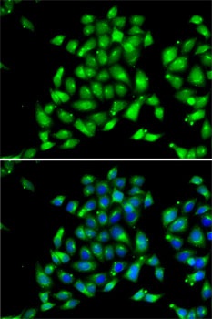 ARFGAP1 Antibody