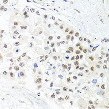 TRMT1 Antibody