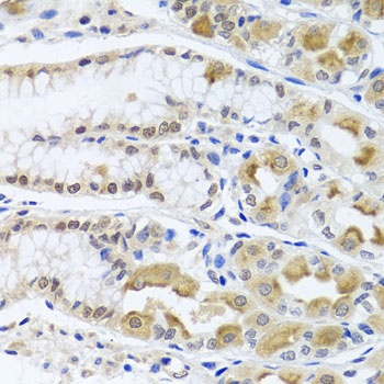 TRMT1 Antibody