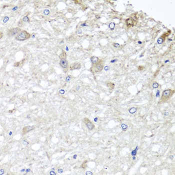 METTL13 Antibody