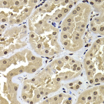 ACTL6B Antibody