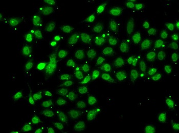 ACTL6B Antibody