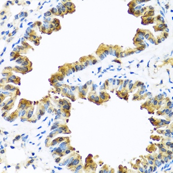 SERPINA10 Antibody