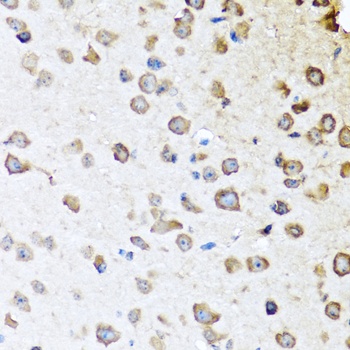 SERPINA10 Antibody