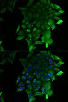 SEPSECS Antibody