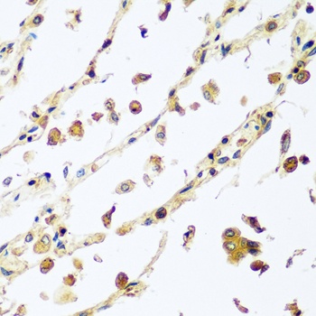 VPS4A Antibody