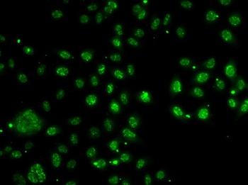 LDLRAP1 Antibody