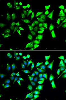 FKBP8 Antibody