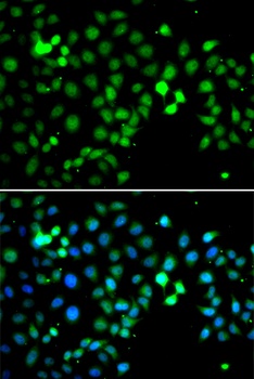 MTF2 Antibody