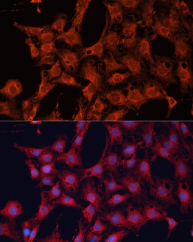 DNAJA2 Antibody