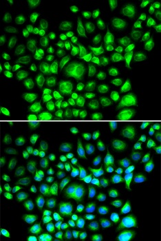 BCAP31 Antibody