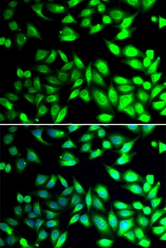 PDIA6 Antibody