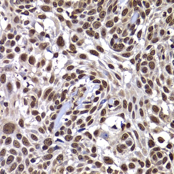 DNAJB6 Antibody