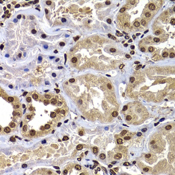 DNAJB6 Antibody