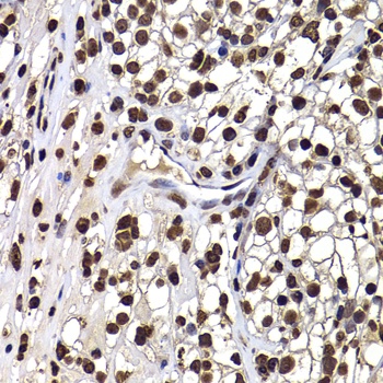 DNAJB6 Antibody