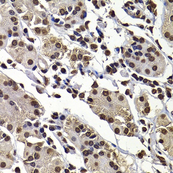 DNAJB6 Antibody