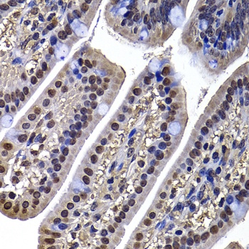 DNAJB6 Antibody