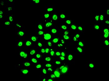 DNAJB6 Antibody