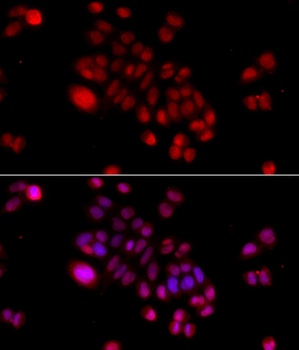 DNAJB6 Antibody