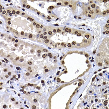 mH2A1 Antibody