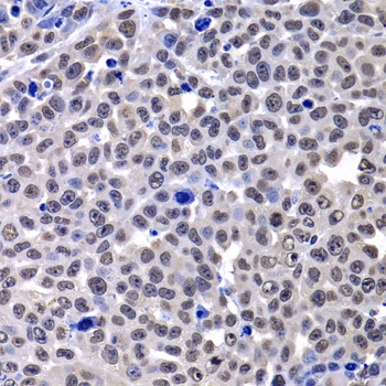 mH2A1 Antibody