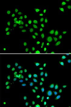 mH2A1 Antibody