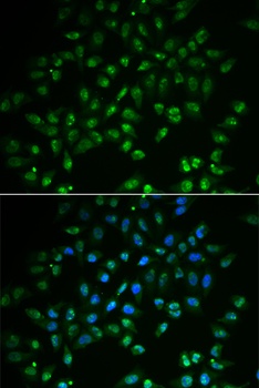 HAND2 Antibody