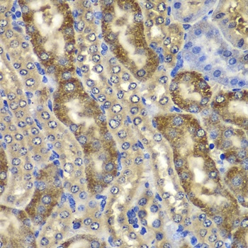 NMT2 Antibody