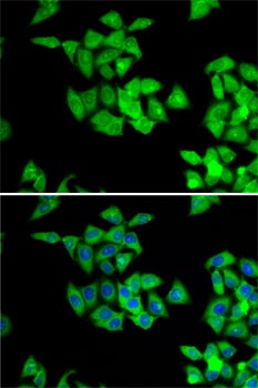 NMT2 Antibody