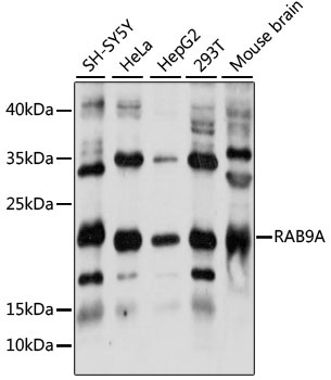 RAB9A Antibody