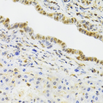 EFTUD2 Antibody