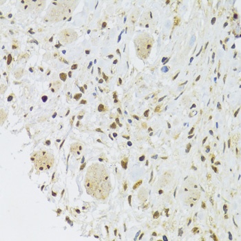 EFTUD2 Antibody