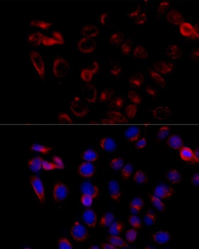 EFTUD2 Antibody