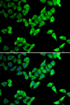 TRIP10 Antibody