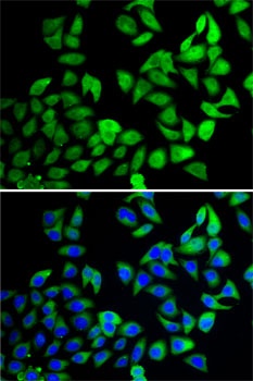 USP8 Antibody