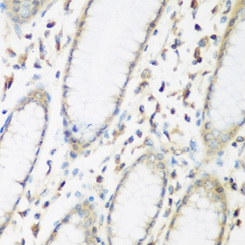 EIF2B2 Antibody