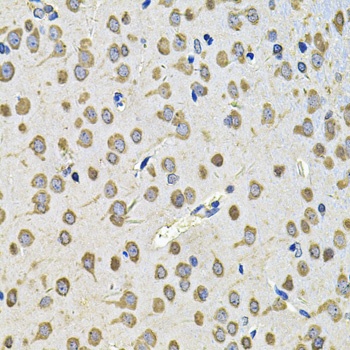 EIF3F Antibody