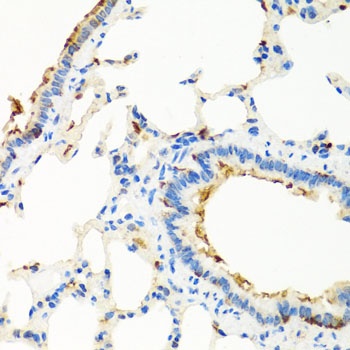 RGS5 Antibody