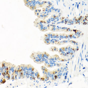 RGS5 Antibody