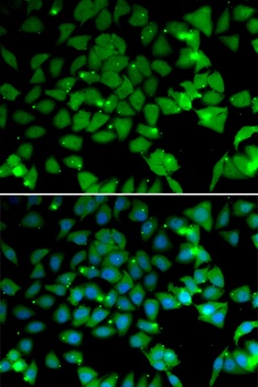 NAA10 Antibody