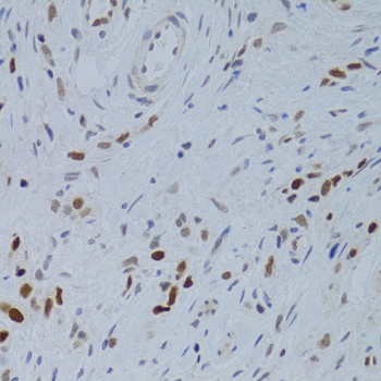 ZNF148 Antibody