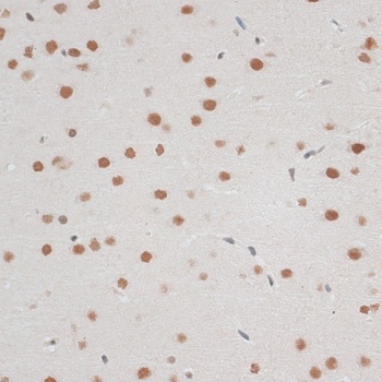 ZNF148 Antibody